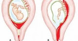 كيف تفرقي بين دم الحيض ودم الحمل , تعريف الحمل الغزلانى