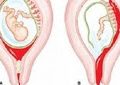 4503 1 كيف تفرقي بين دم الحيض ودم الحمل - تعريف الحمل الغزلانى مفيدة جلال